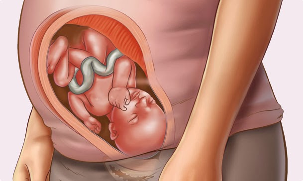 diabetes gestacional bebé moviéndose menos 32